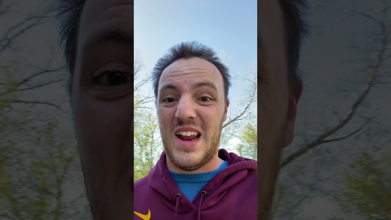 L4-L5 Microdiscectomy Update - No Pain at All!