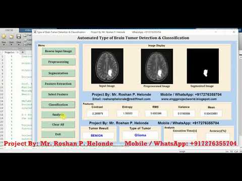 Type of Brain Tumor Detection and Classification Using Matlab Project Source Code