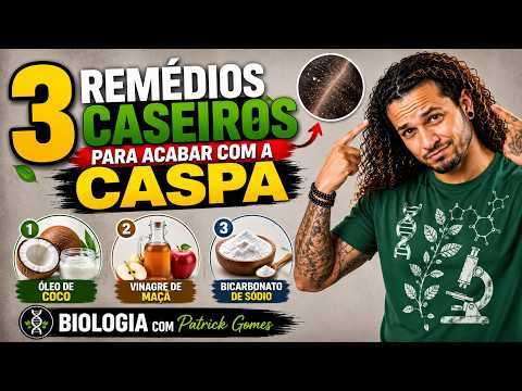3 Remédios Caseiros para Acabar com a Caspa