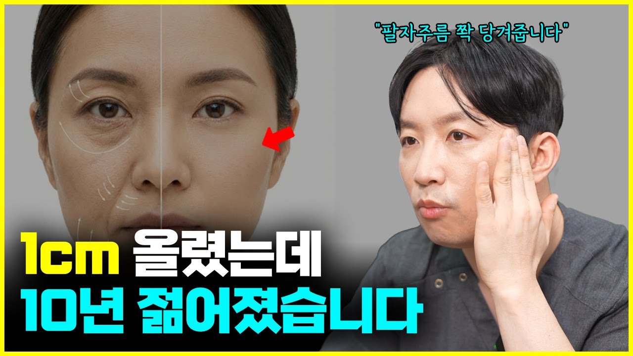 불독살, 팔자주름 고민 한 방에 해결! 막스거상의 모든 것 (Feat. 안면거상과 차이점, 효과, 막스거상이 효과적인 나이)