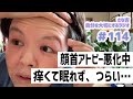 【ラジオ】顔首アトピーまだ悪化中…（5月9日）／夜何度も起きる…／久々つらい【さな吉・自分を大切にするラジオ】#114