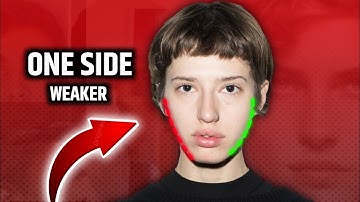 Facial Asymmetry: Why One Side of Your Jaw is Smaller – Real Science & Fixes