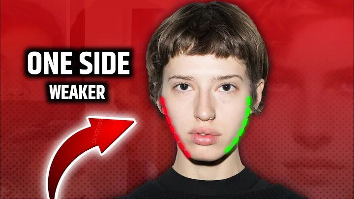 Facial Asymmetry: Why One Side of Your Jaw is Smaller – Real Science & Fixes