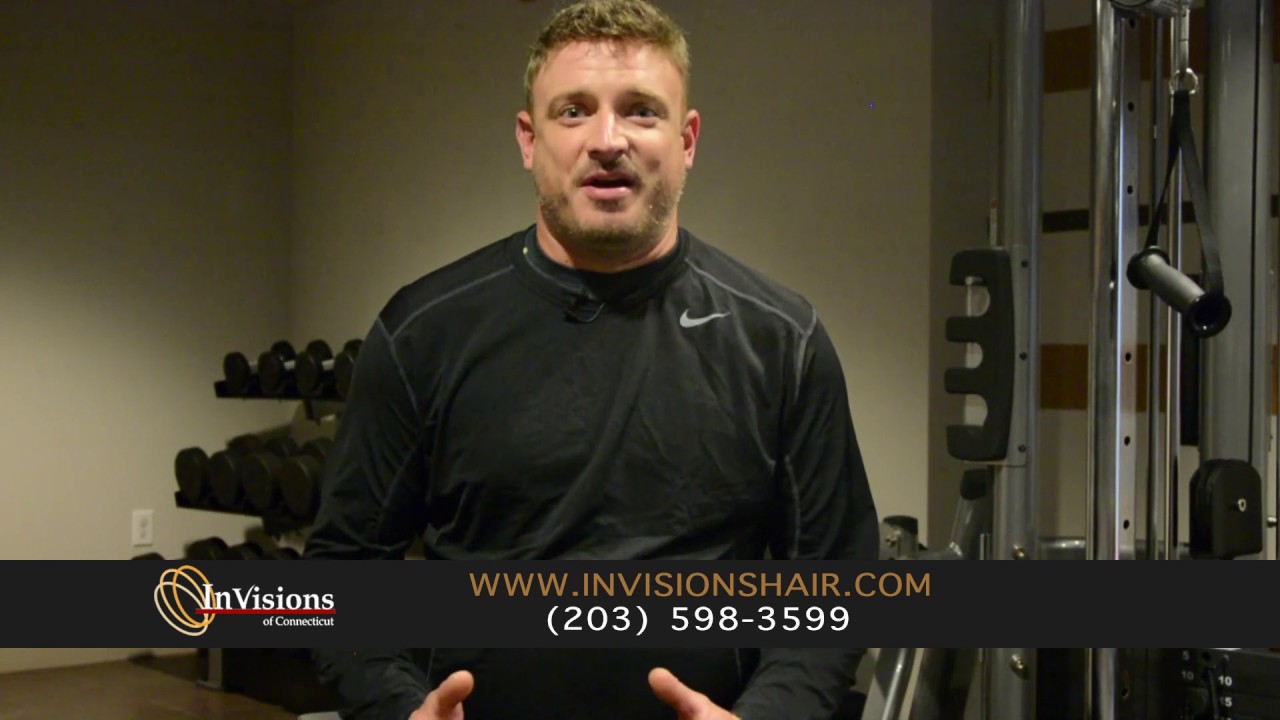 Invisions Hair Replacement Connecticut Jesse's Testimonial YouTube
