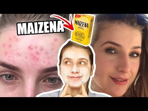 Limpeza de pele caseira que remove cravos, espinhas, deixa a pele lisinha e também clareia manchas! . 