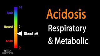 Acidosis, Respiratory and Metabolic, Animation