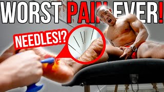 The WORST PAIN! | Fixing 30 YEARS Of Flat Feet w/ Trigger Point Massage