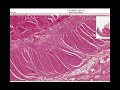 Anatomy | Histology of the Colon [Large Intestine]
