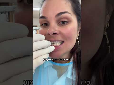 אל תעצבנו את השיננית שלכם 