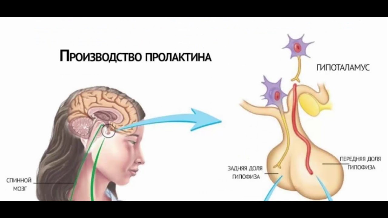 Почему бывает высокий пролактин у женщин? - YouTube