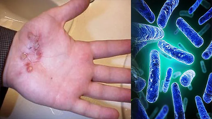 WHAT HAPPENS WHEN YOU DON'T WASH YOUR HANDS...