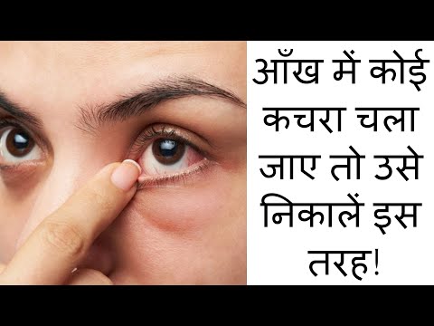 आँख से कचरा निकालने का तरीका | Eyes Care tips Hindi