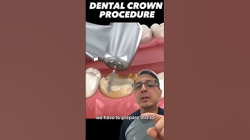 How to Prepare for a Dental Crown (SIMPLY EXPLAINED) | In Office to Hands On Dental Training #shorts