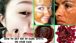 মেছতা দূর করার উপায়/how to get rid of dark spots on your face/মুখের কালো দাগ দূর করা/ #skincare screenshot 5
