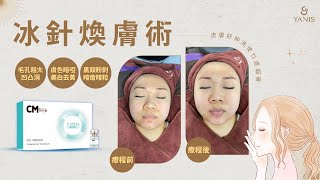 Yanis Beauty • 使乜遮瑕膏!
