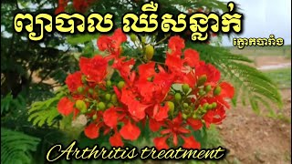 Arthritis treatment ព្យាបាល ឈឺសន្លាក់