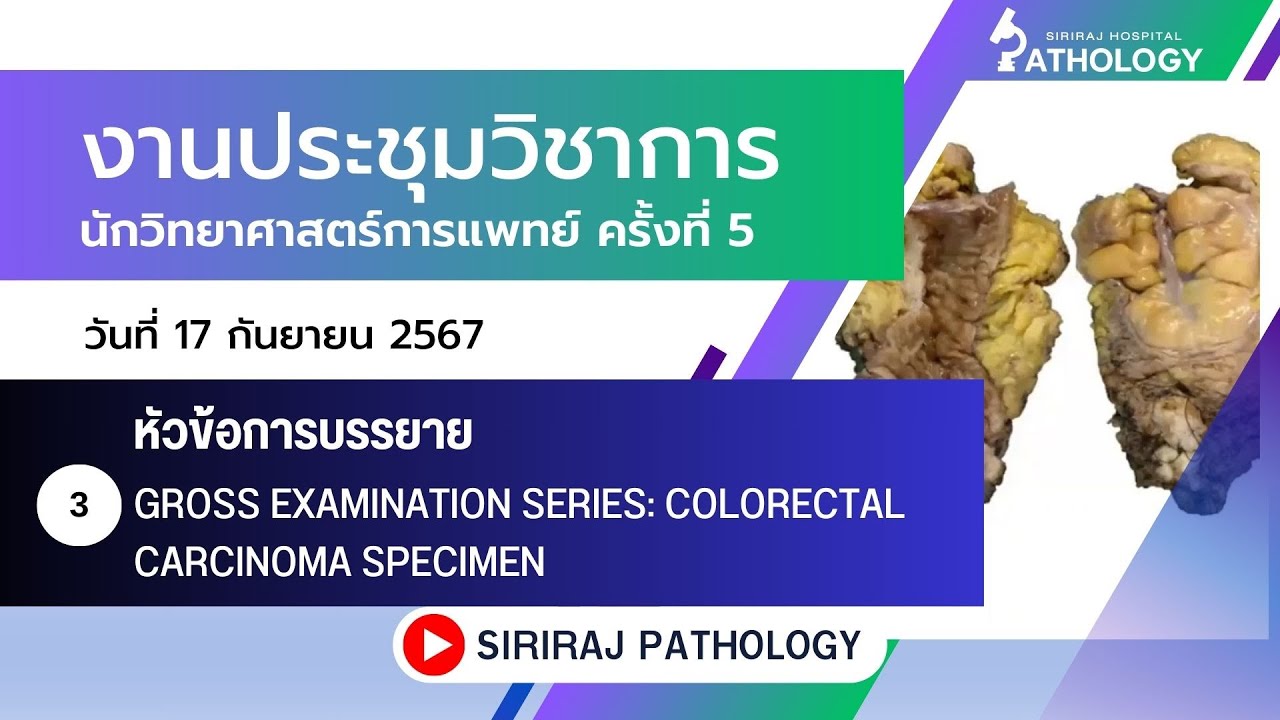 gross-examination-series-colorectal-carcinoma-specimen-youtube
