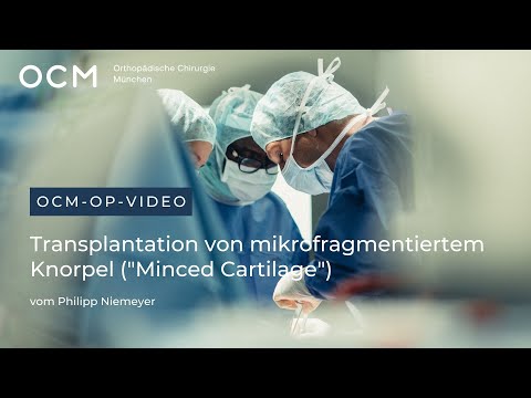 Operationsvideo | "Minced Cartilage" zur Behandlung von Knorpelschäden am Kniegelenk