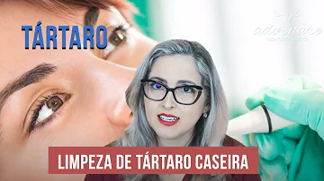 Como remover tártaro e placa bacteriana?