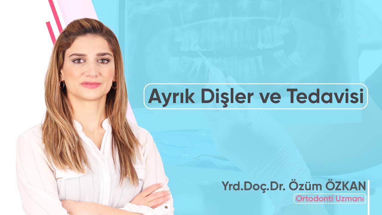 Ayrık Dişler ve Tedavisi