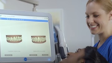 iTero Element® Orthodontic Patient Video