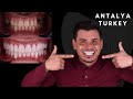 Best Dental Clinic Antalya - Turkey - Best Prices - Best Technology and Best Smile Makeover / Turkey