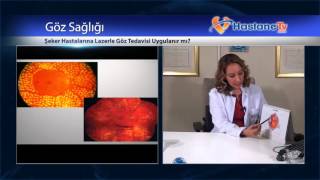 Şeker Hastalarına Lazerle Göz Tedavisi Uygulanır Mı?