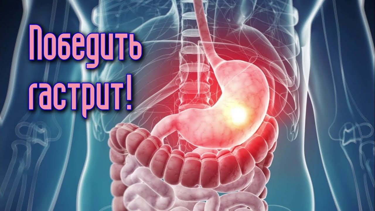 7 ПРОДУКТОВ, которые ПОМОГУТ ПОБЕДИТЬ ГАСТРИТ - YouTube