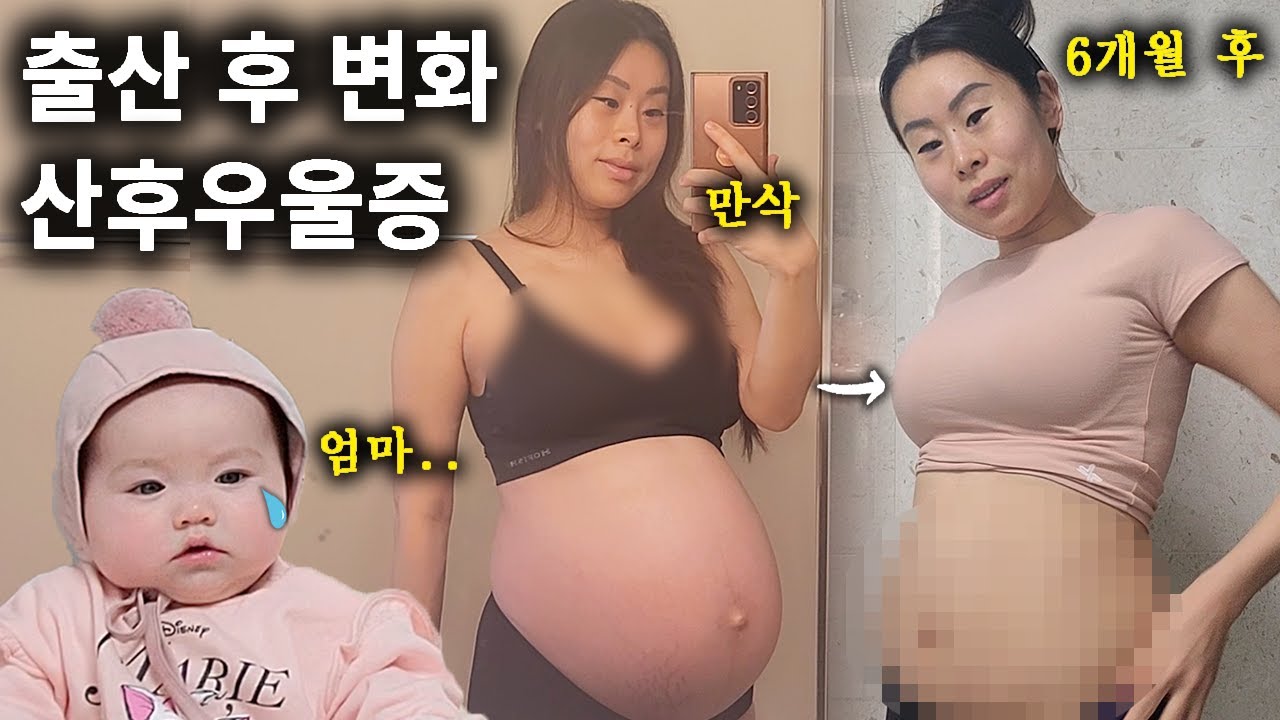 미국 출산 후 산후우울증이 찾아왔다.. 완모 6개월 후 신체 변화 (🚨매우 심각한 상태)
