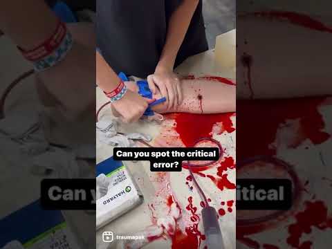 Video: Puas phlebotomy txo cov ntshav siab?