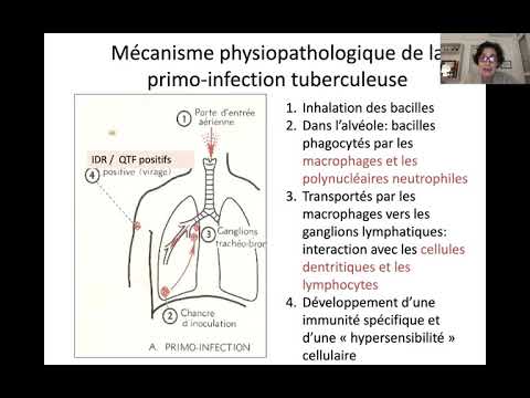CEC Pneumo-Allergologie Pédiatrique – Séminaire 2 - Dr AGNES HAMZAOUI