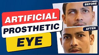 Artificial (Prosthetic) Eye which Moves & Looks like Natural Eye | Nakli Aankh Lagane Ka Operation screenshot 1