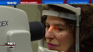 Eye exam to detect early stages of Alzheimer's Disease