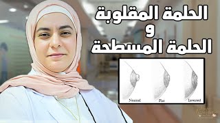 .الحلمة المقلوبة و الحلمة المسطحة.. بدائل الببرونة.