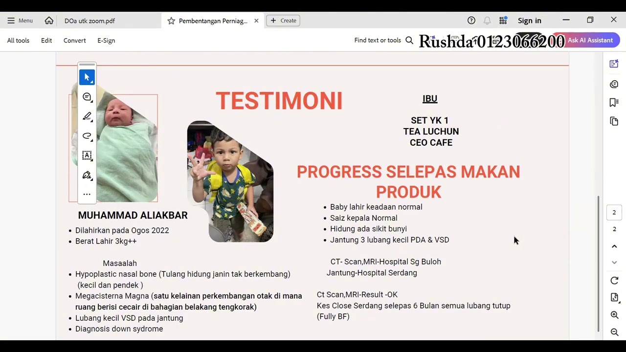 ZM(5) Testimoni Jantung Berlubang - shuang hor