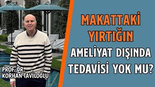 Makattaki Yırtığın Ameliyat Dışında Tedavisi Yok Mu? - Prof. Dr. Korhan Taviloğlu