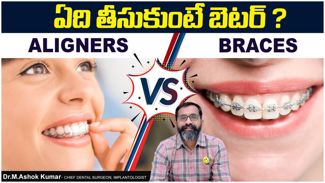 ఎత్తు,వంకర పళ్ళకి ఏది బెస్ట్ .? | Clear Aligners vs Braces: Which is Best? | Eledent Dental Hospital