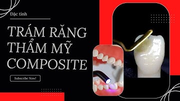Đặc tính của trám răng thẩm mỹ composite  | Tt niềng răng quốc tế Diamond