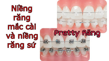 So sánh niềng răng mắc cài kim loại và mắc cài sứ