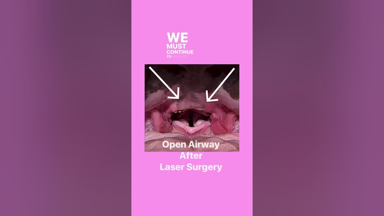 elongated-soft-palate-animal-welfare-issue-in-flat-faced-dogs-youtube