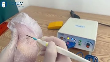 Mini Electric Ion Cautery with Price Under USD300/unit