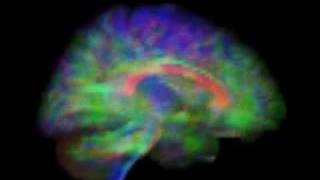 DTI Brain Rendering