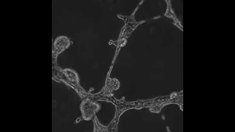 MCF10 branching morphogenesis
