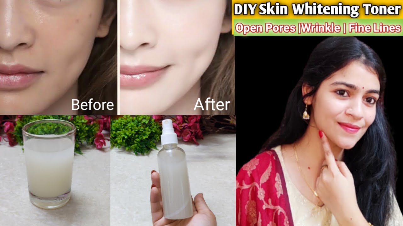 चेहरे के OPEN PORES, LARGE PORES और CLOGGED PORES की परेशानी को दूर