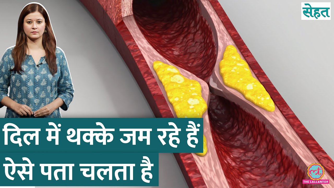 Heart Blockage से Heart Attack का ख़तरा! दिल में थक्के जमने से ऐसे रोकें | Sehat Ep. 1226