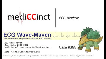 Atrial Flutter With Variable Block and Acute MI (ECG Wave-Maven) Case #388