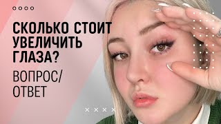 КАК УВЕЛИЧИВАЮТ  ГЛАЗА В КОРЕЕ | СКОЛЬКО СТОИТ КАНТОПЛАСТИКА | БЛЕФАРОПЛАСТИКА В КОРЕЕ