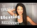 The truth about bloating in eating disorder recovery  beautybeyondbones edrecovery