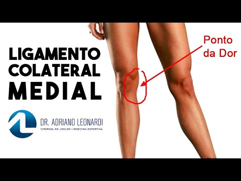 Vídeo: Joelho Hiperextendido: Sintomas, Tratamento, Recuperação