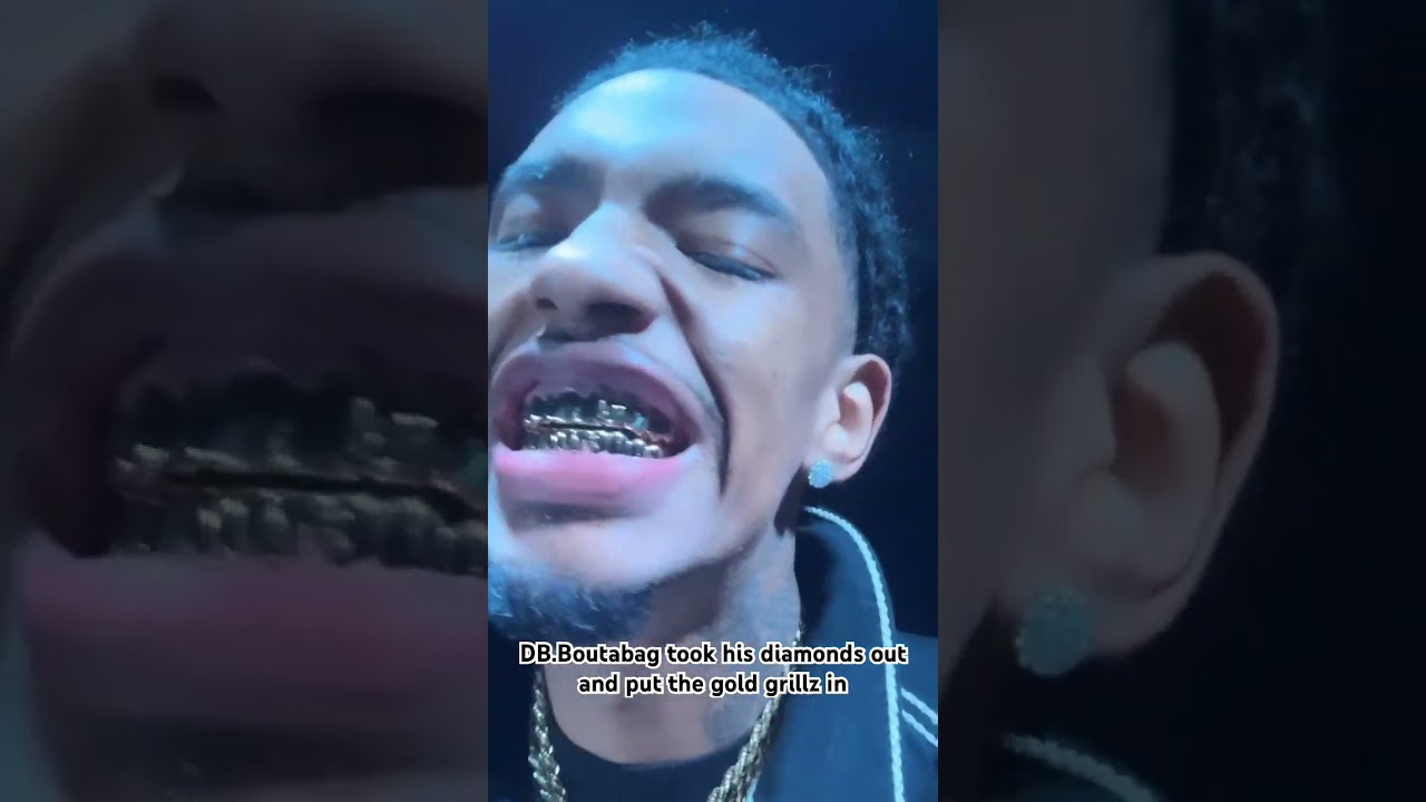 Do you think he should have kept his diamond grill ? 